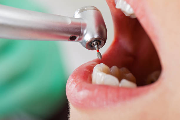 Best Emergency Dental Care for Trauma or Injury in Lincoln Center, KS